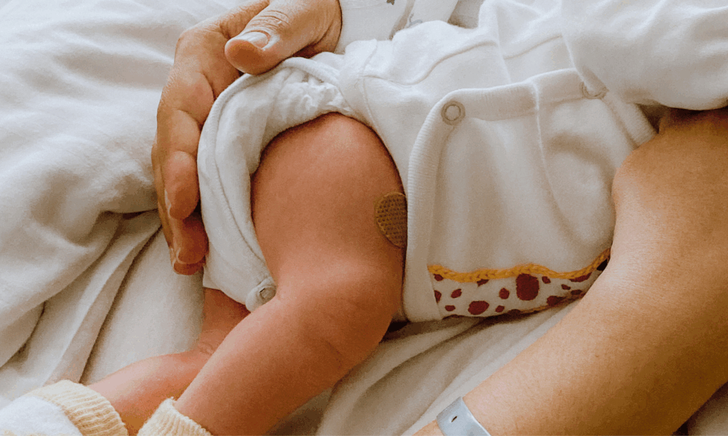 Photograph of baby, with vaccine bandage on thigh.
